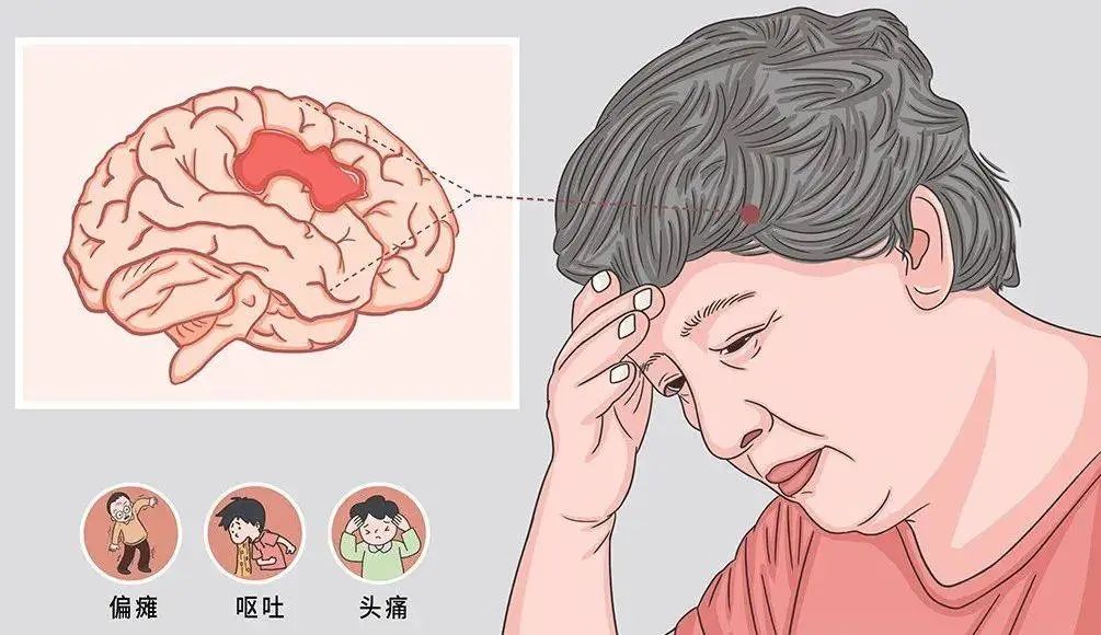 “缘点科技”提醒您,夏日炎炎,警惕这个冬天高发疾病“偷袭”!
