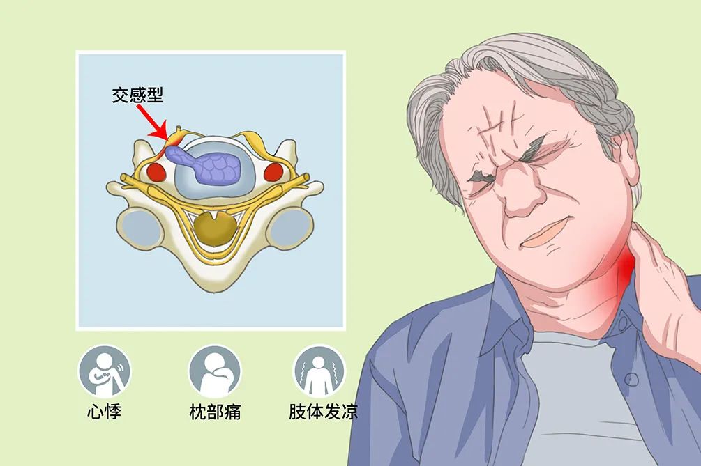 “缘点科技”知识小课堂 | 颈椎病有多危险？颈椎不好的人，一定要看！